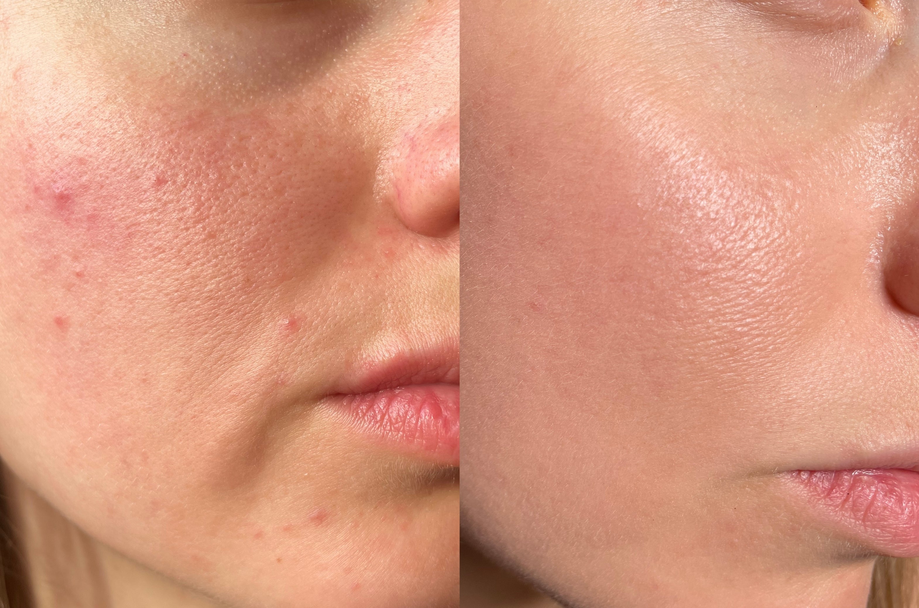 Female Applying Product on Smooth Skin