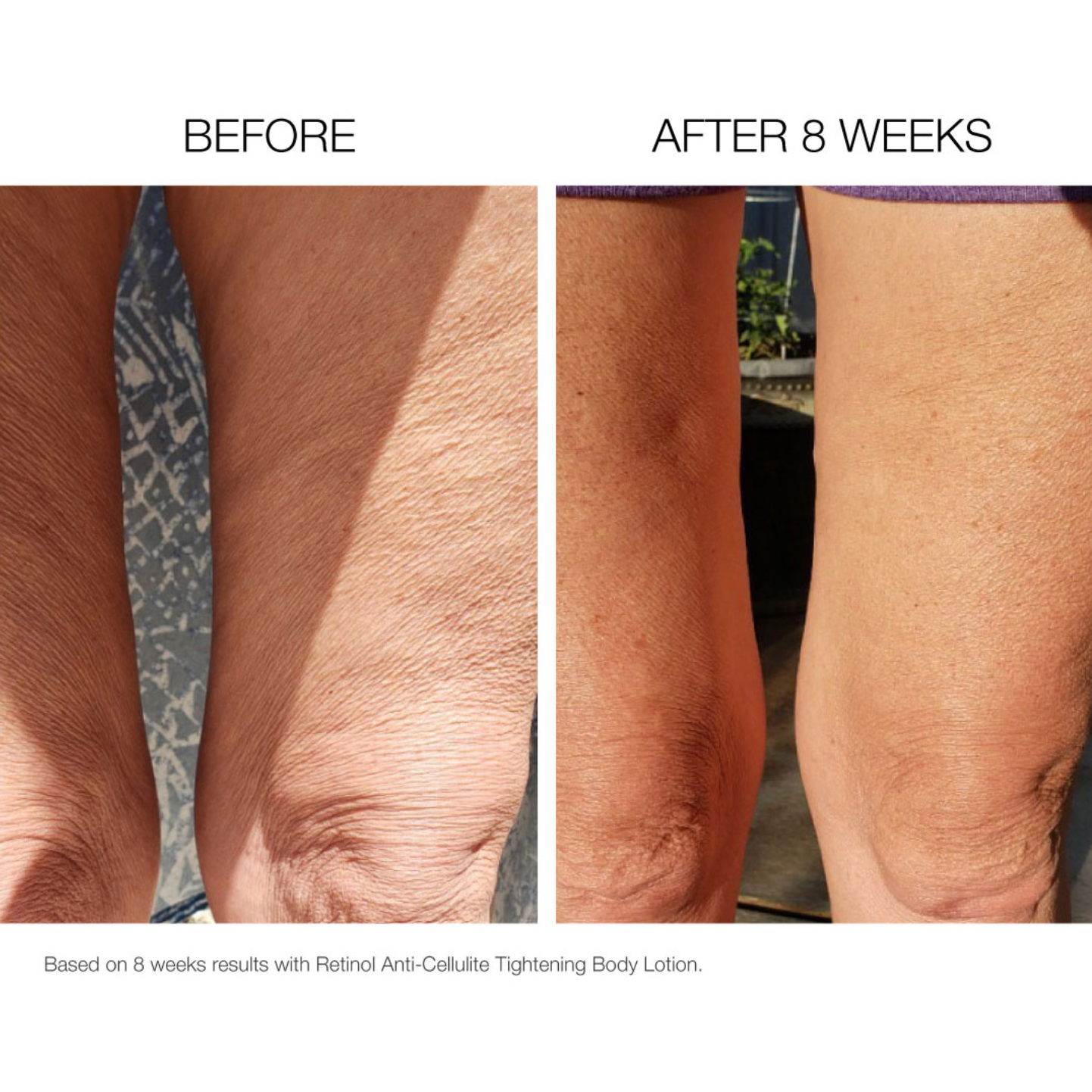 Retinol Anti-Cellulite Tightening Body Lotion