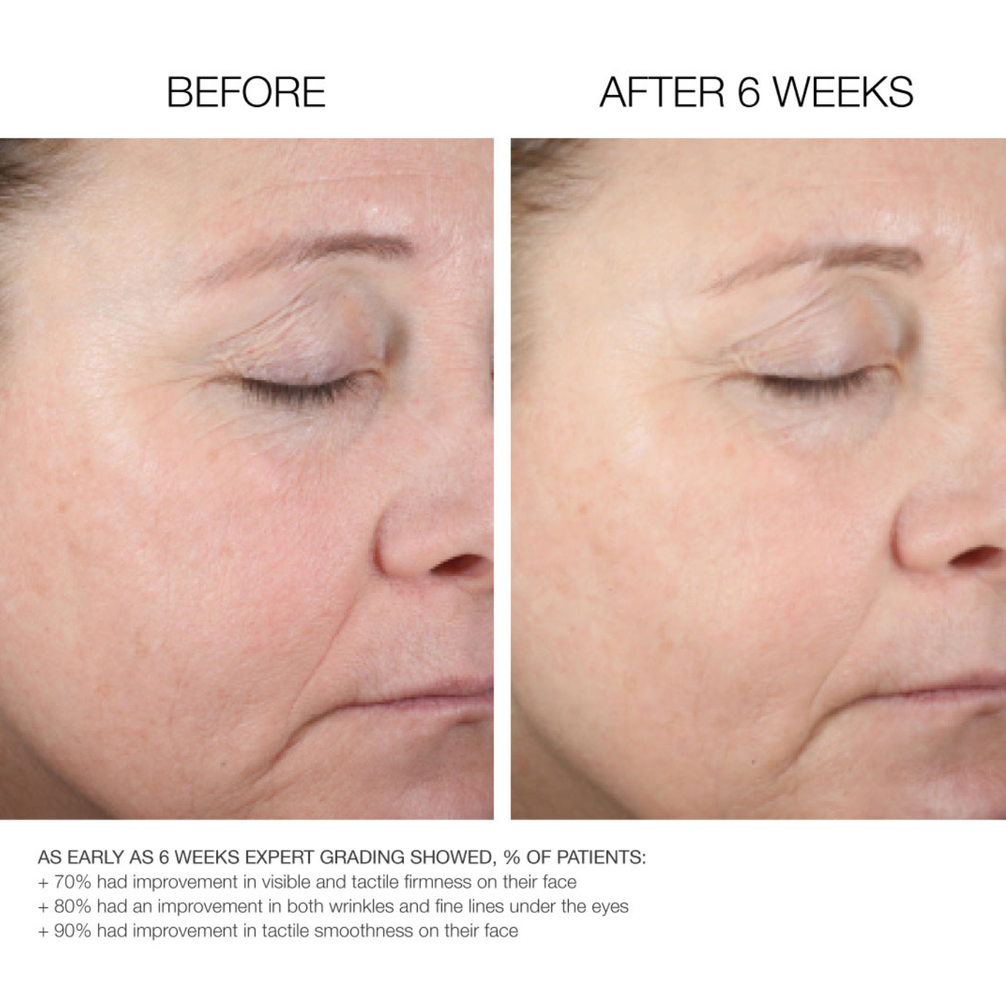 Rejuv Advanced Fractionated HA Boosting Serum