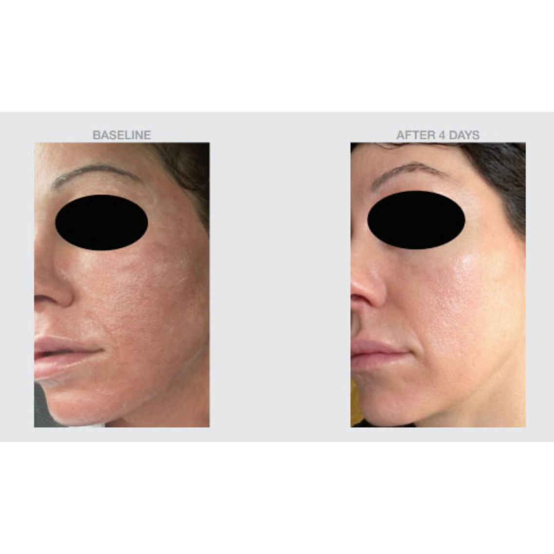 Phyto Multi-Correction Serum