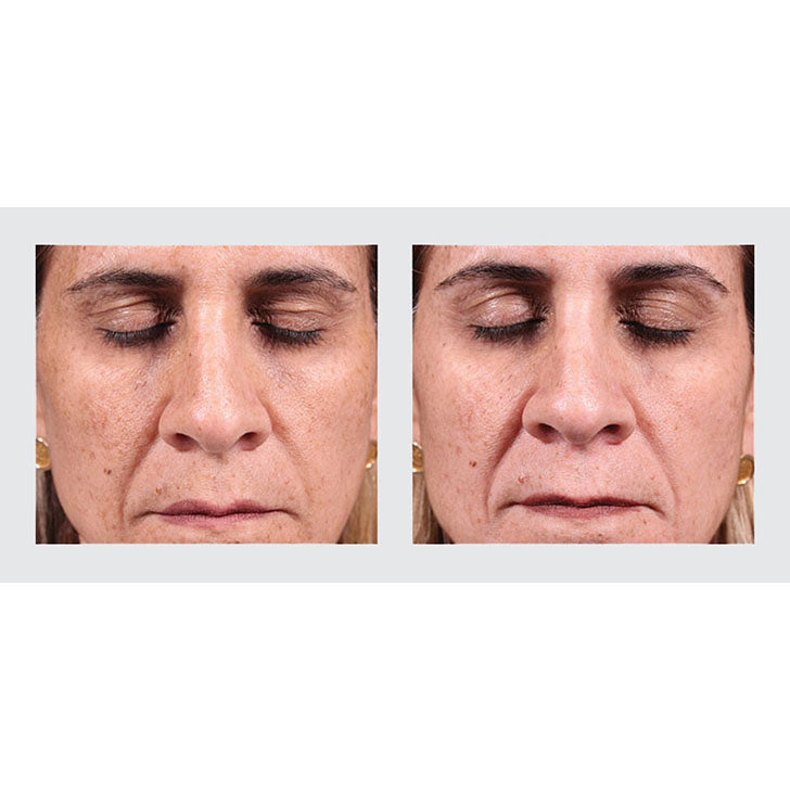 Fade Away Pigment Lifting Cream